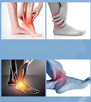 足と足首の手術　Surgery of the foot and ankle 2冊 足・足関節の最新の手術 (OS NEXUS(電子版付き) 19) | 中村 茂